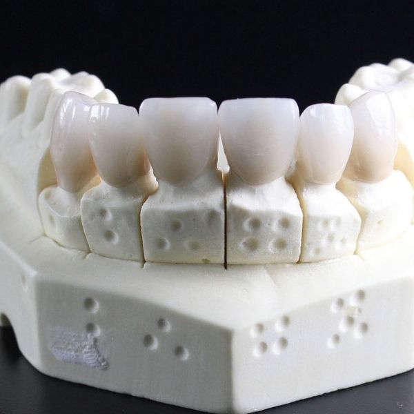 About Porcelain Laminate Teeth: A Complete Guide