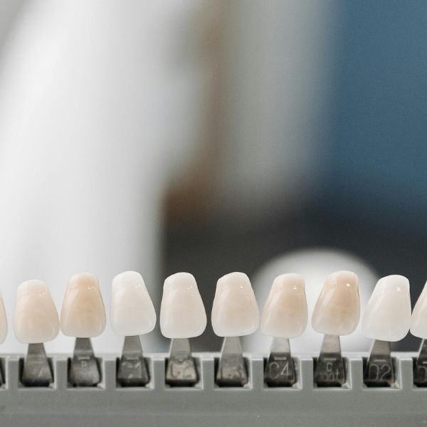 What are the components of a dental implant